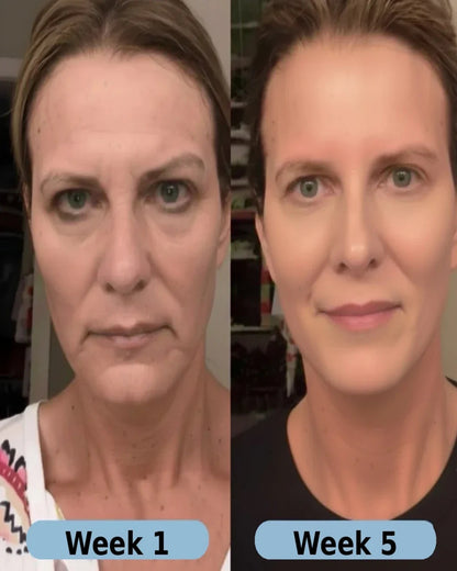 VoluFine® | Korean Collagen Serum for Mature Skin